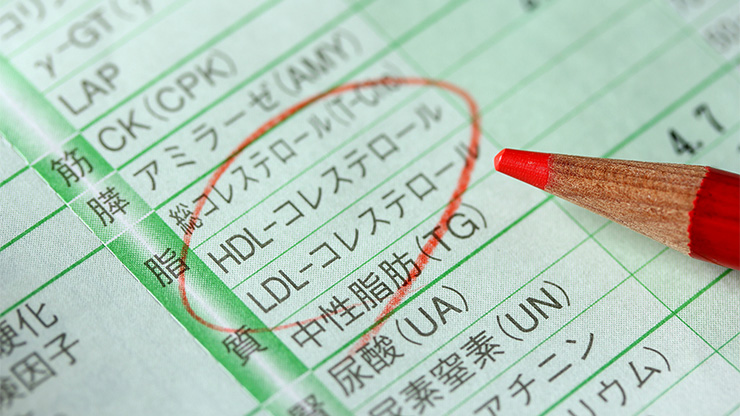 コレステロール値が気になる人が増えている背景